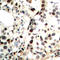 Checkpoint Kinase 2 antibody, LS-C358945, Lifespan Biosciences, Immunohistochemistry frozen image 