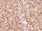 Calreticulin 3 antibody, NBP1-33337, Novus Biologicals, Immunohistochemistry paraffin image 