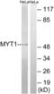Protein Kinase, Membrane Associated Tyrosine/Threonine 1 antibody, LS-B8377, Lifespan Biosciences, Western Blot image 
