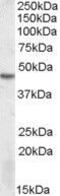 Serine/Threonine Kinase 17b antibody, GTX88405, GeneTex, Western Blot image 