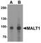 MALT1 Paracaspase antibody, A01599, Boster Biological Technology, Western Blot image 