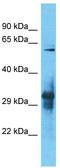 IgLON family member 5 antibody, TA337350, Origene, Western Blot image 