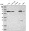 Arginyl Aminopeptidase antibody, HPA036074, Atlas Antibodies, Western Blot image 