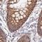 Mitochondrial Antiviral Signaling Protein antibody, NBP2-38704, Novus Biologicals, Immunohistochemistry paraffin image 