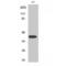 Mitogen-Activated Protein Kinase Kinase 4 antibody, LS-C380773, Lifespan Biosciences, Western Blot image 