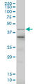 LIM Homeobox 4 antibody, LS-B5479, Lifespan Biosciences, Western Blot image 