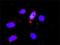 Cyclin Dependent Kinase 6 antibody, H00001021-M01, Novus Biologicals, Proximity Ligation Assay image 