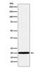 Ubiquitin Conjugating Enzyme E2 C antibody, M01491-1, Boster Biological Technology, Western Blot image 