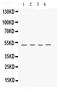 Keratocan antibody, PB9653, Boster Biological Technology, Western Blot image 