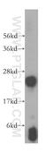 Glutathione S-Transferase Mu 4 antibody, 16766-1-AP, Proteintech Group, Western Blot image 