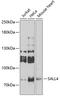 Spalt Like Transcription Factor 4 antibody, 22-720, ProSci, Western Blot image 