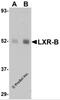 Nuclear Receptor Subfamily 1 Group H Member 2 antibody, 5579, ProSci Inc, Western Blot image 