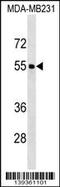 Forkhead box protein Q1 antibody, 60-141, ProSci, Western Blot image 