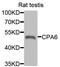 Carboxypeptidase A6 antibody, abx006350, Abbexa, Western Blot image 