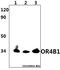 Olfactory Receptor Family 4 Subfamily B Member 1 antibody, A17689-1, Boster Biological Technology, Western Blot image 