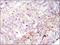 Protein Tyrosine Kinase 2 antibody, NBP2-22168, Novus Biologicals, Immunohistochemistry paraffin image 
