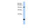 Tight Junction Protein 2 antibody, 25-808, ProSci, Western Blot image 