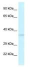 ALKBH1 antibody, NBP1-79909, Novus Biologicals, Western Blot image 