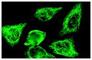 Vimentin antibody, sc-6260, Santa Cruz Biotechnology, Immunofluorescence image 