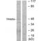 Tripartite Motif Containing 59 antibody, A07207, Boster Biological Technology, Western Blot image 