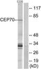 Centrosomal Protein 70 antibody, TA315829, Origene, Western Blot image 