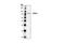 Eukaryotic Translation Initiation Factor 2B Subunit Epsilon antibody, 3595S, Cell Signaling Technology, Western Blot image 