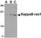 NF-kappa-B inhibitor-interacting Ras-like protein 1 antibody, MBS150526, MyBioSource, Western Blot image 