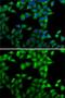 Mannose Phosphate Isomerase antibody, GTX64661, GeneTex, Immunocytochemistry image 