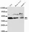 Arrestin Beta 1 antibody, LS-B13063, Lifespan Biosciences, Western Blot image 