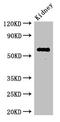 Testis Expressed Basic Protein 1 antibody, LS-C677344, Lifespan Biosciences, Western Blot image 