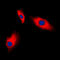 Actin Gamma 2, Smooth Muscle antibody, LS-C351784, Lifespan Biosciences, Immunofluorescence image 