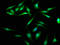 Kinesin Family Member C1 antibody, LS-C670549, Lifespan Biosciences, Immunofluorescence image 