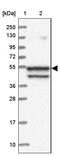Spermatogenesis Associated 7 antibody, HPA038083, Atlas Antibodies, Western Blot image 