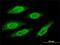 MAGE Family Member A8 antibody, H00004107-M01, Novus Biologicals, Immunocytochemistry image 