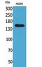 Patatin Like Phospholipase Domain Containing 6 antibody, PA5-51106, Invitrogen Antibodies, Western Blot image 