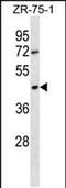 Olfactory Receptor Family 2 Subfamily T Member 6 antibody, PA5-48728, Invitrogen Antibodies, Western Blot image 