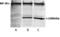 Neurofilament Medium antibody, LS-C204562, Lifespan Biosciences, Western Blot image 