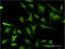 E3 ubiquitin-protein ligase RING1 antibody, H00006015-M07, Novus Biologicals, Immunofluorescence image 