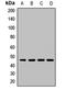 Eukaryotic Translation Initiation Factor 3 Subunit G antibody, LS-C668136, Lifespan Biosciences, Western Blot image 