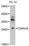 Cyclin Dependent Kinase Inhibitor 1B antibody, LS-C748654, Lifespan Biosciences, Western Blot image 