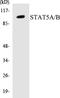 Signal Transducer And Activator Of Transcription 5A antibody, EKC1546, Boster Biological Technology, Western Blot image 