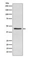 Inhibin Subunit Alpha antibody, M02413-2, Boster Biological Technology, Western Blot image 