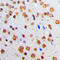 Adar2 antibody, LS-C351788, Lifespan Biosciences, Immunohistochemistry paraffin image 