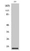LTO1 Maturation Factor Of ABCE1 antibody, STJ94833, St John