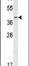 Calponin 3 antibody, PA5-13525, Invitrogen Antibodies, Western Blot image 