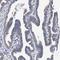 Protein Phosphatase 5 Catalytic Subunit antibody, NBP1-87240, Novus Biologicals, Immunohistochemistry paraffin image 