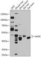 NAD Kinase antibody, 23-795, ProSci, Western Blot image 