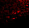 TBK1 Binding Protein 1 antibody, A10984, Boster Biological Technology, Immunofluorescence image 