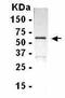 Protein Kinase C Theta antibody, PA1-20874, Invitrogen Antibodies, Western Blot image 