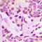 Iroquois-class homeodomain protein IRX-3 antibody, LS-C356132, Lifespan Biosciences, Immunohistochemistry paraffin image 